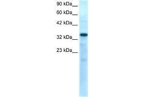 WB Suggested Anti-TBX10 Antibody Titration:  0. (T-Box 10 antibody  (N-Term))