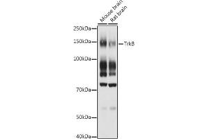 Western blot analysis of extracts of various cell lines, using TrkB antibody (ABIN3022911, ABIN3022912, ABIN3022913 and ABIN6219292) at 1:1000 dilution.