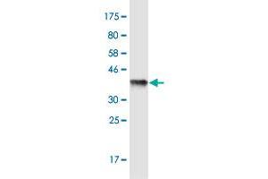 Western Blot detection against Immunogen (36. (FKBP10 antibody  (AA 377-470))