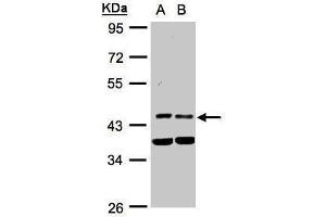 WB Image Sample(30 ug whole cell lysate) A:HeLa S3, B:MOLT4 , 10% SDS PAGE antibody diluted at 1:1000 (PDK1 antibody)