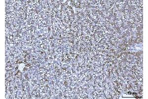 IHC analysis of GLUD1/2 using anti-GLUD1/2 antibody (ABIN7602000). (GLUD1 / GLUD2 (AA 54-553) antibody)