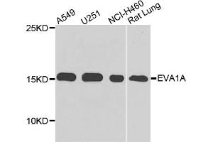 Western blot analysis of extracts of various cell lines, using EVA1A antibody (ABIN5975697) at 1/1000 dilution. (TMEM166 antibody)