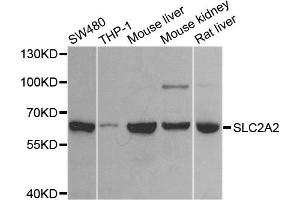 Western blot analysis of extracts of various cell lines, using SLC2A2 antibody. (SLC2A2 antibody)