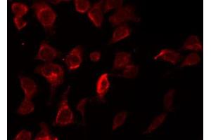 ABIN6269302 staining HepG2 by IF/ICC. (XIAP antibody  (N-Term))