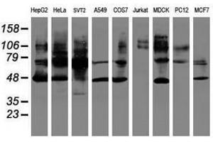 Image no. 2 for anti-serpin Peptidase Inhibitor, Clade B (Ovalbumin), Member 1 (SERPINB1) (AA 77-306) antibody (ABIN1491672) (SERPINB1 antibody  (AA 77-306))