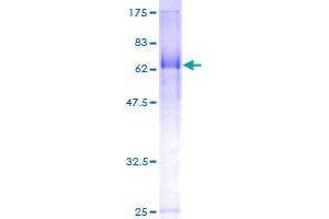 FBXL20 Protein (AA 1-436) (GST tag)