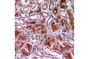 Immunohistochemical analysis of c-Rel staining in human kidney formalin fixed paraffin embedded tissue section. (c-Rel antibody  (C-Term))