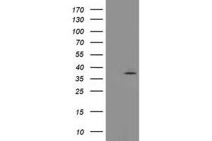 Western Blotting (WB) image for anti-Translocase of Outer Mitochondrial Membrane 34 (TOMM34) antibody (ABIN1501469) (TOMM34 antibody)