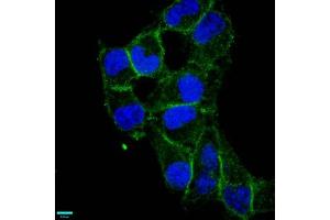 Immunofluorescence staining of Hela cells with ABIN7127287 at 1:87. (Recombinant CD97 antibody)