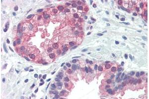 Human Prostate (formalin-fixed, paraffin-embedded) stained with BNIP3 antibody ABIN461995 at 10 ug/ml followed by biotinylated anti-mouse IgG secondary antibody ABIN481714, alkaline phosphatase-streptavidin and chromogen. (BNIP3 antibody  (AA 112-124))