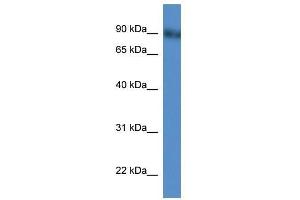 Western Blot showing Pde4d antibody used at a concentration of 1-2 ug/ml to detect its target protein. (PDE4D antibody  (N-Term))