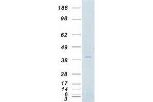 Western Blotting (WB) image for Aurora Kinase B (AURKB) protein (Myc-DYKDDDDK Tag) (ABIN2715084)