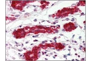 Immunohistochemistry (IHC) image for anti-Programmed Cell Death 4 (PDCD4) (AA 1-469), (N-Term) antibody (ABIN317548) (PDCD4 antibody  (N-Term))