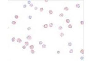 Immunocytochemistry of ATP11B in K562 cells with ATP11B antibody at 10 μg/ml.