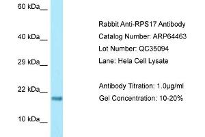 Western Blotting (WB) image for anti-Ribosomal Protein S17 (RPS17) (Middle Region) antibody (ABIN2789845) (RPS17 antibody  (Middle Region))