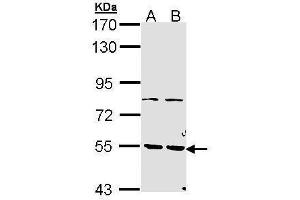 WB Image Sample (30 ug of whole cell lysate) A: H1299 B: Hela 7. (PDE1A antibody)