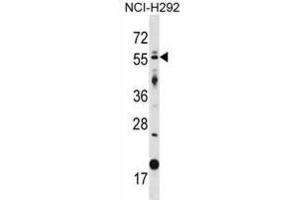 Western Blotting (WB) image for anti-GLIS Family Zinc Finger 2 (GLIS2) antibody (ABIN2998792)