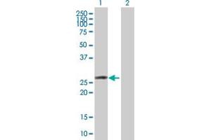 Western Blot analysis of OSTF1 expression in transfected 293T cell line by OSTF1 MaxPab polyclonal antibody. (OSTF1 antibody  (AA 1-217))
