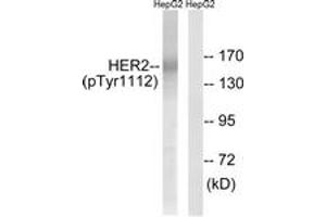Western blot analysis of extracts from HepG2 cells treated with PMA 125ng/ml 20', using HER2 (Phospho-Tyr1112) Antibody.