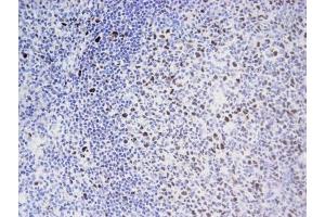 EED mAb tested by Immunohistochemistry . (EED antibody)