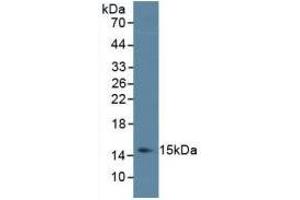 Detection of IL4 in Porcine Spleen Tissue using Monoclonal Antibody to Interleukin 4 (IL4) (IL-4 antibody  (AA 25-153))