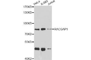 Western blot analysis of extracts of various cell lines, using RACGAP1 antibody (ABIN5973044) at 1/1000 dilution. (RACGAP1 antibody)