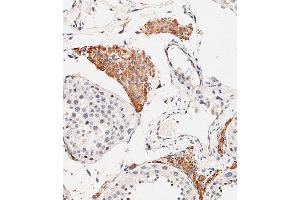 Immunohistochemical analysis of paraffin-embedded human testis tissue using C performed on the Leica® BOND RXm. (OTUD3 antibody  (AA 192-220))