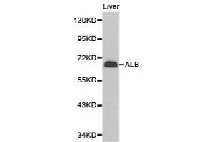 Western Blotting (WB) image for anti-Albumin (ALB) antibody (ABIN2650895) (Albumin antibody)