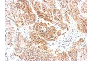 IHC-P Image CXCR6 antibody [N2C1], Internal detects CXCR6 protein at cytosol on Cal27 xenograft by immunohistochemical analysis. (CXCR6 antibody)