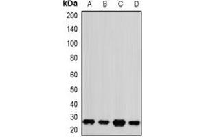 Western blot analysis of PSMA2 expression in Jurkat (A), Hela (B), NIH3T3 (C), mouse brain (D) whole cell lysates. (PSMA2 antibody)