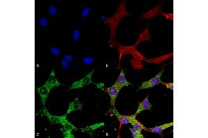 Immunocytochemistry/Immunofluorescence analysis using Mouse Anti-GABA-A Receptor Alpha 4 Monoclonal Antibody, Clone S398A-34 (ABIN2485782). (GABRA1 antibody  (AA 410-450) (FITC))