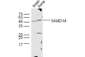 Lane 1: Mouse brain lysates, Lane 2: Mouse bone lysates probed with SAMD14 Polyclonal Antibody, unconjugated  at 1:300 overnight at 4°C followed by a conjugated secondary antibody at 1:10000 for 60 minutes at 37°C. (SAMD14 antibody  (AA 231-330))