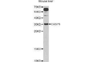 Western blot analysis of extracts of mouse liver, using CASP6 Antibody (ABIN5970901) at 1/1000 dilution. (Caspase 6 antibody)