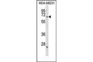 Western blot analysis of FZD2 / Frizzled-2 Antibody (C-term) in MDA-MB231 cell line lysates (35ug/lane).
