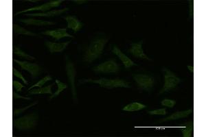 Immunofluorescence of monoclonal antibody to GRK4 on HeLa cell. (GRK4 antibody  (AA 36-145))