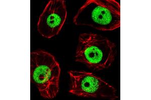 Fluorescent image of MDA-M cells stained with TPD52L3 Antibody (N-term) A. (TPD52L3 antibody  (N-Term))