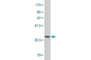 Western Blot detection against Immunogen (36. (CAND1 antibody  (AA 1-100))