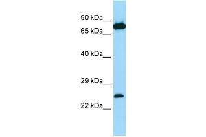 Host: Rabbit Target Name: SNX27 Sample Type: Jurkat Whole Cell lysates Antibody Dilution: 1. (SNX27 antibody  (C-Term))