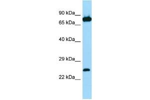 Host: Rabbit Target Name: SNX27 Sample Type: Jurkat Whole Cell lysates Antibody Dilution: 1.