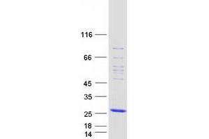 Glia Maturation Factor, beta (GMFB) protein (Myc-DYKDDDDK Tag)