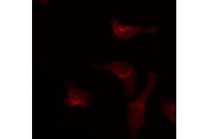 ABIN6274841 staining HepG2 by IF/ICC. (NECAB3 antibody  (Internal Region))