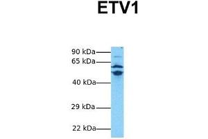 Host:  Rabbit  Target Name:  ETV1  Sample Tissue:  Human MDA-MB-435s  Antibody Dilution:  1. (ETV1 antibody  (Middle Region))