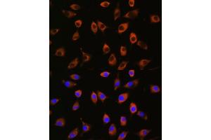 Immunofluorescence analysis of L929 cells using PPP1R9B antibody (ABIN7269681) at dilution of 1:100. (PPP1R9B antibody)