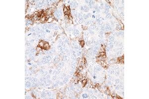 Immunohistochemistry (IHC) image for anti-CD40 (CD40) (AA 227-277) antibody (ABIN7454023) (Recombinant CD40 antibody  (AA 227-277))