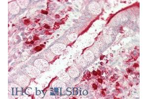 IHC-P analysis of Human Intestine Tissue, with HE staining. (Angiotensin I Converting Enzyme 1 antibody  (AA 814-1071))