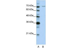 WB Suggested Anti-PRPF3 Antibody Titration:  0. (PRPF3 antibody  (N-Term))
