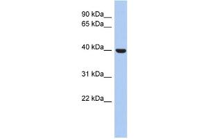 WB Suggested Anti-STOML3 Antibody Titration: 0. (STOML3 antibody  (N-Term))