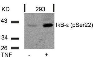 Western blot analysis of extracts from 293 cells untreated or treated with TNF using IkB-e(Phospho-Ser22) Antibody. (NFKBIE antibody  (pSer22))