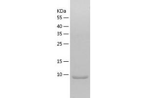 SUMO4 Protein (AA 1-93) (His tag)