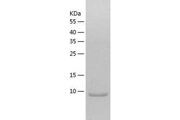 SUMO4 Protein (AA 1-93) (His tag)